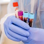 Анализы крови в международной клинике Медика24