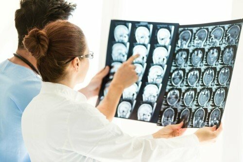 для чего назначают МРТ головного мозга с контрастом