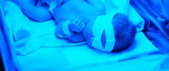 Лечение желтухи у новорожденного