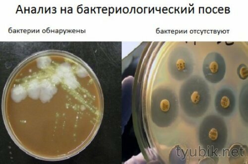 Посев на бактерии