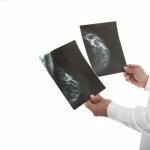 Расшифровка данных рентгеновской маммографии