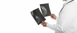 Расшифровка данных рентгеновской маммографии