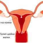 Размеры матки в норме у женщин по УЗИ. Таблица по возрасту, нерожавших, при беременности, после родов, при менопаузе