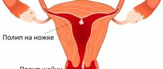 Размеры матки в норме у женщин по УЗИ. Таблица по возрасту, нерожавших, при беременности, после родов, при менопаузе