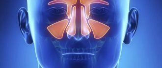 Рентген носовых пазух