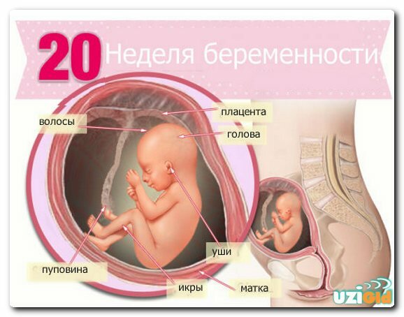 узи 20 недель беременность