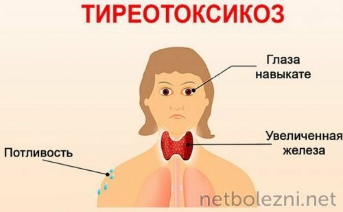 Заболевание щитовидной железы